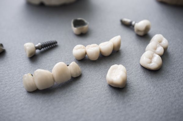 How Does A Dental Crown Protect Your Tooth?