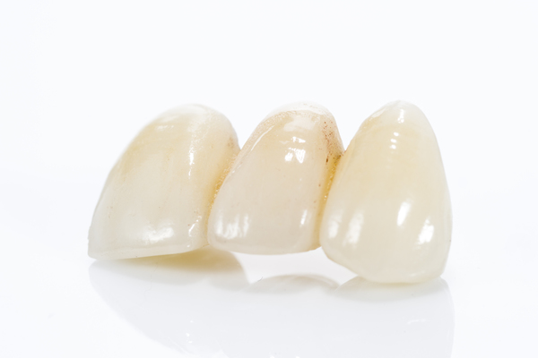 Is A Dental Bridge Right For You?