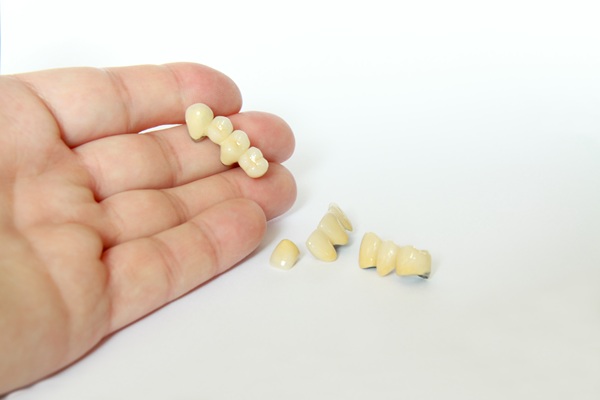 A Snapshot Of The Four Types Of Dental Bridges