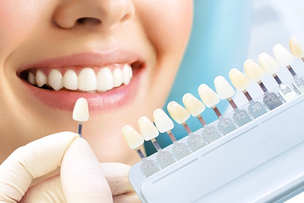Tips To Keep Your Dental Veneers Looking Brand New