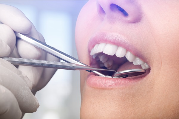 Routine Dental Care: What Are Tooth Colored Fillings?