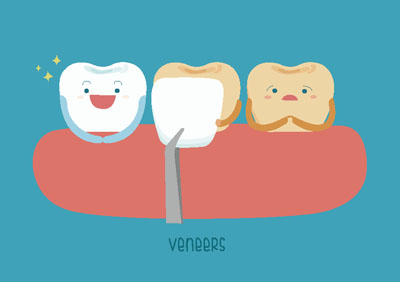 Why You Should Visit A Veneers Dentist Office