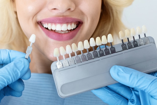 Smile Makeover: Different Types Of Veneers